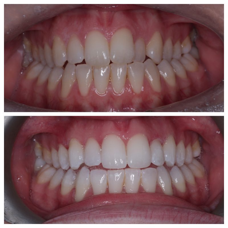 Smile Gallery - Rayner Dental Practice, Bradford, West Yorkshire