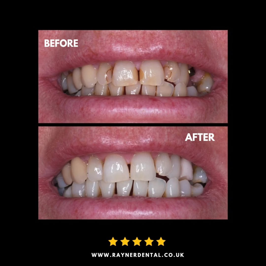 528072997 1326863392781652 4031919397578552340 n